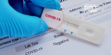 Pruebas Covid-19 en Bogotá 26 de mayo. Conoce aquí donde te pueden atender