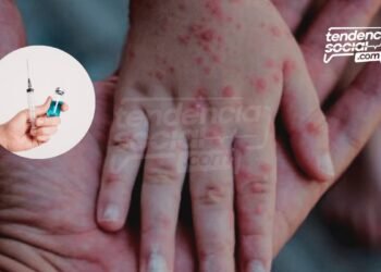 Por qué y dónde vacunar a los niños contra la rubéola y sarampión ¡Gratis!