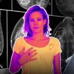 Cancer de mama en Colombia 2025